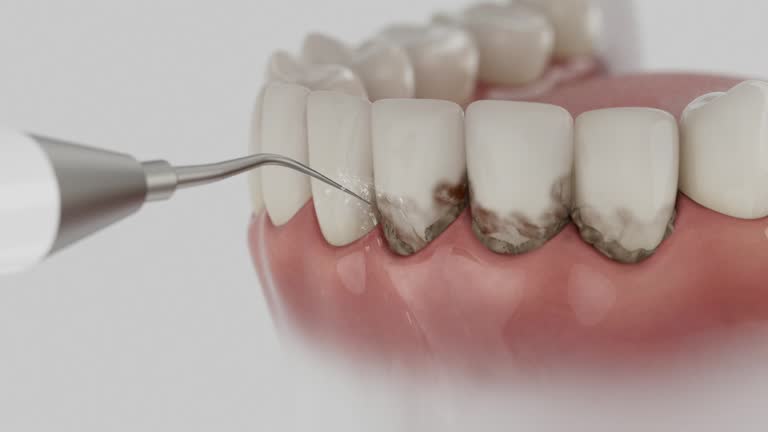 Reliable Invisalign Clear Aligners contractor in Johnson County County, IL by Dentist Open Now